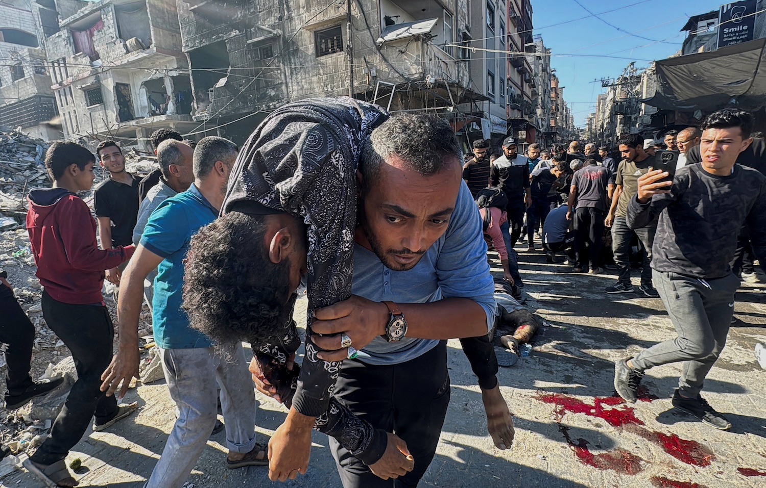 A Palestinian carries an injured person following an Israeli strike, amid the Israel-Hamas conflict, in Beit Lahiya in the northern Gaza Strip October 30, 2024. REUTERS/Stringer